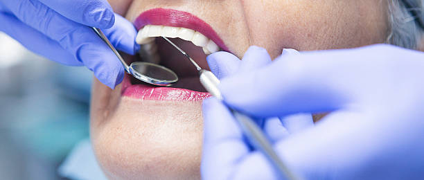 Best Emergency Gum Treatment in Webberville, MI